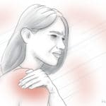 calcific tendonitis and severe shoulder pain