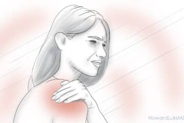 calcific tendonitis and severe shoulder pain