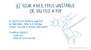 knee instability is a sign of as serious knee injury