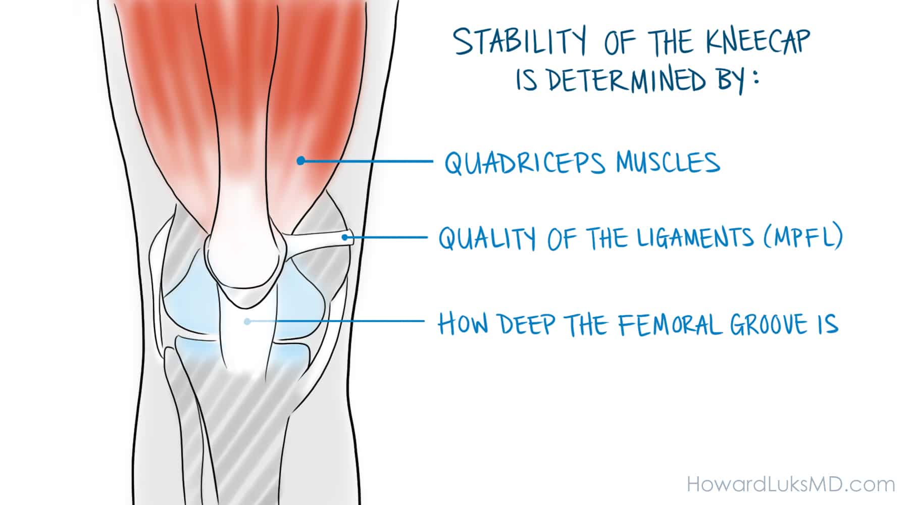 The Dislocated Patella Or Kneecap It Is More Common Than You Think