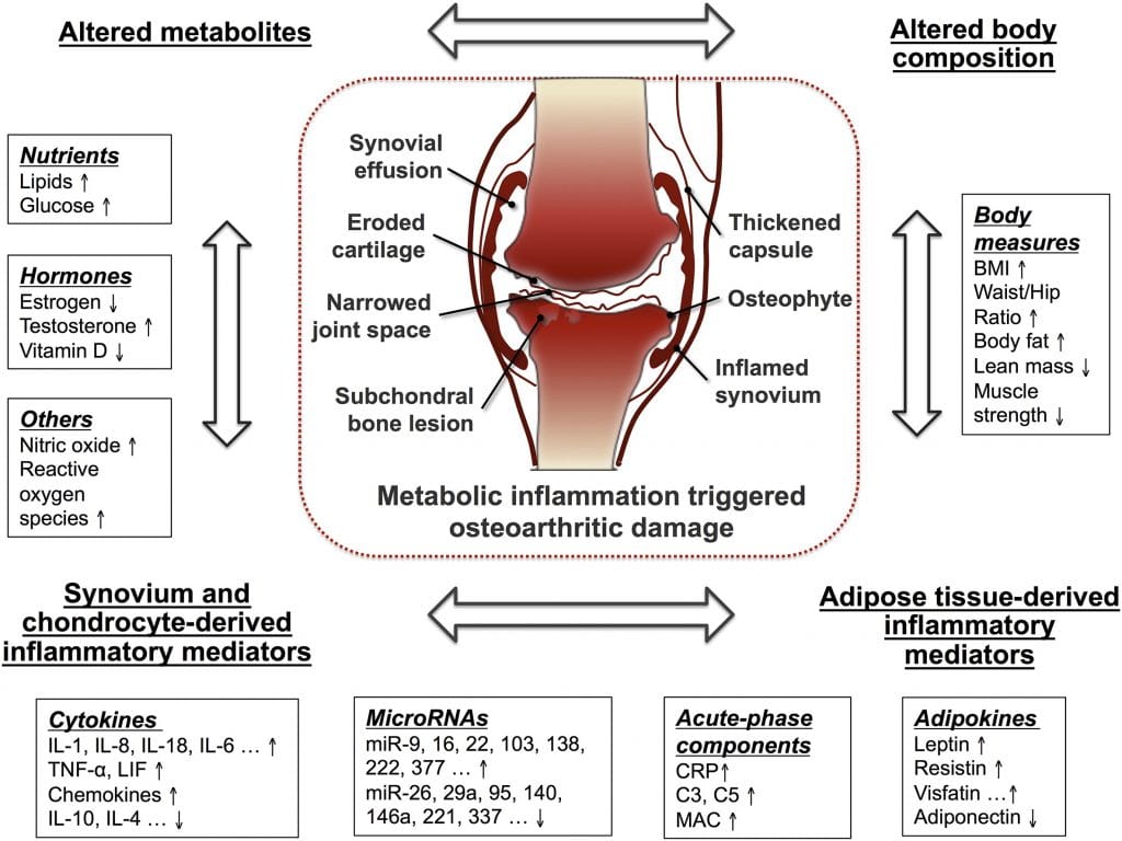 inflammation and knee arthritis
