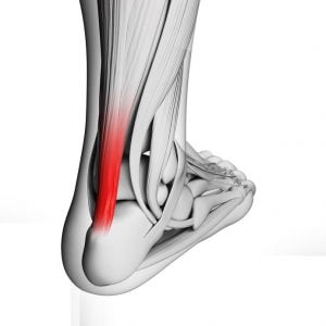 Achilles tendinopathy neuroplastic training