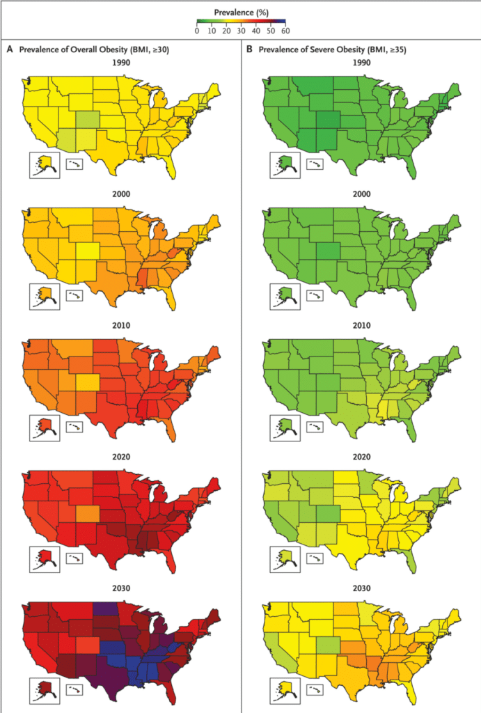 obesity predictions for the US