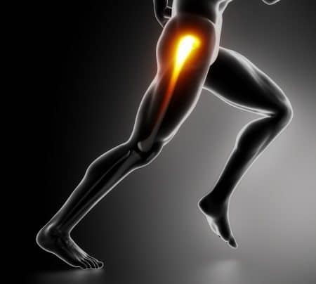 Outer hip Pain in Runners