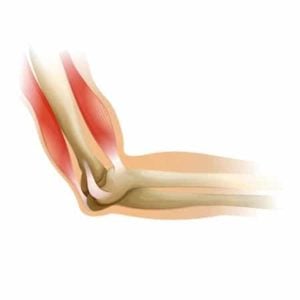elbow pain anatomy
