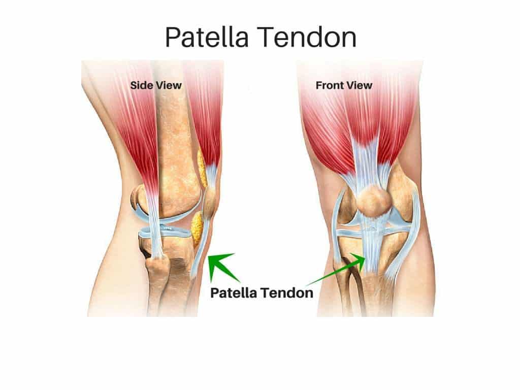 Patellar Tendon Tears