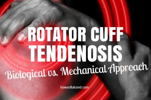 rotator cuff tendinosis