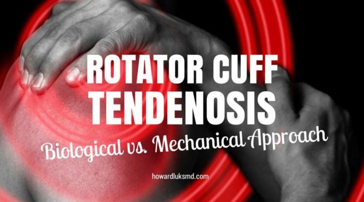 rotator cuff tendinosis