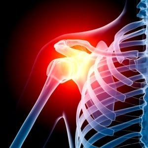 shoulder pain - Howard Luks, MD - Westchester County NY