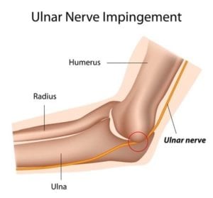 Elbow pain ulnar nerve