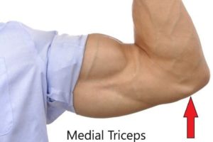 snapping triceps syndrome